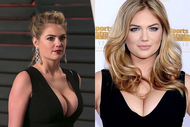 anne taggart recommends Kate Upton Boob Job