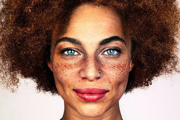 amber yusuf share mixed girl with freckles photos