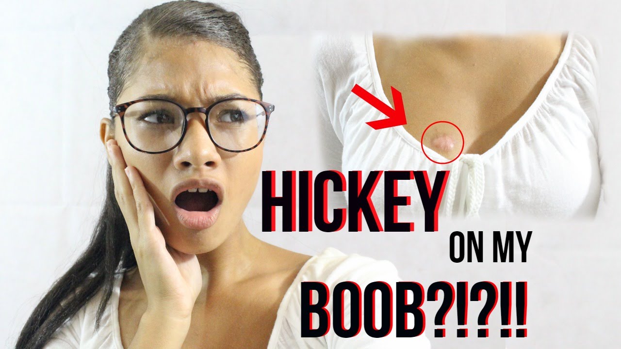 billie lingruen recommends How To Give Hickey On Breast