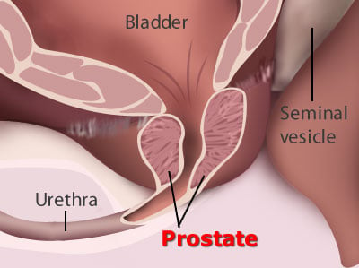 donna crebbin recommends External Prostate Massage Techniques