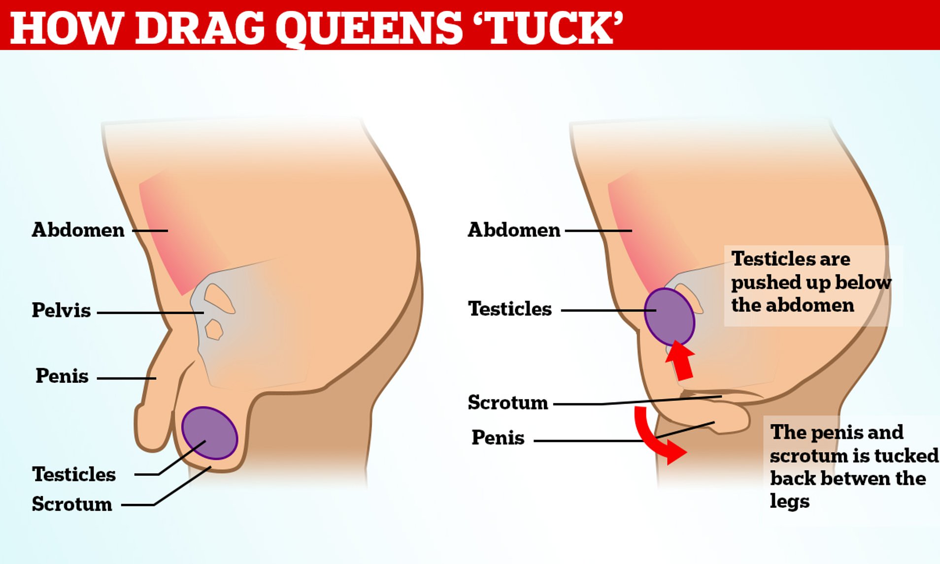 arman omidvar recommends inguinal canal tucking pic