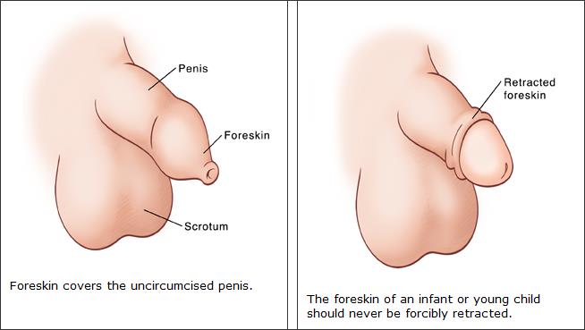 carlo garciano recommends How To Suck An Uncircumsized Penis