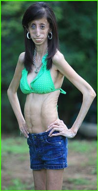 dindin syarifudin recommends skinnest girl in the world pic