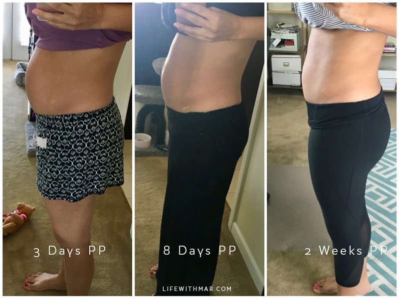 alex larrabee recommends girdle before after pictures pic
