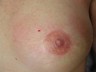ameerali lashari recommends are big areolas normal pic