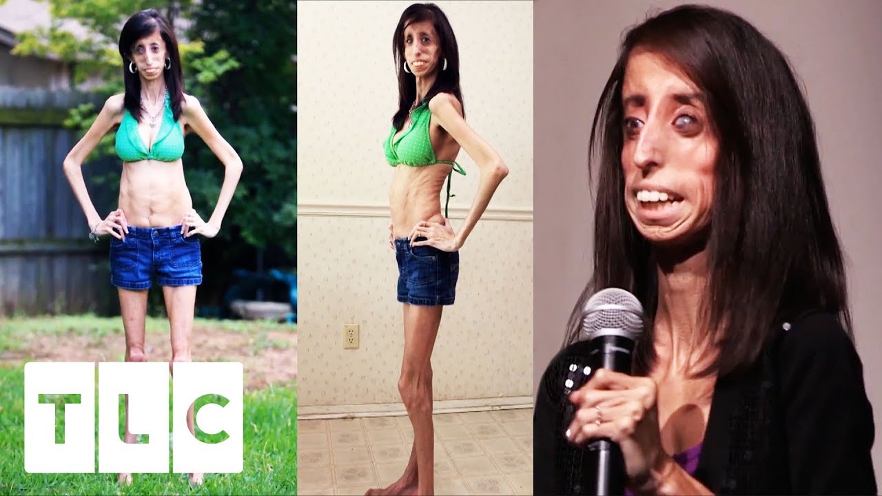 brandi mccormack recommends skinnest girl in the world pic