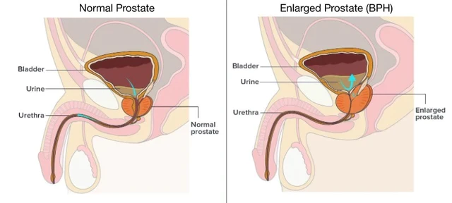 Best of External prostate massage techniques
