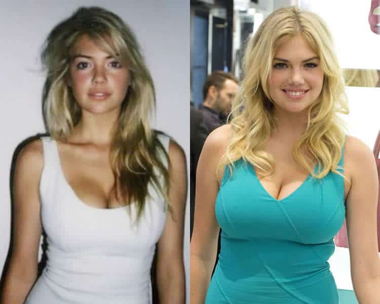 christopher laidlaw recommends Kate Upton Boob Job