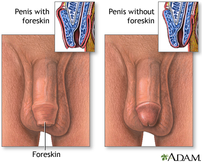 ashton baca recommends uncircumcised penis photo pic